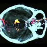 Digital konst – Teresa tar konsten in i framtiden